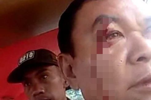 TNI-Polisi Bentrok di Tapanuli Utara, Pangdam Bukit Barisan Minta Maaf