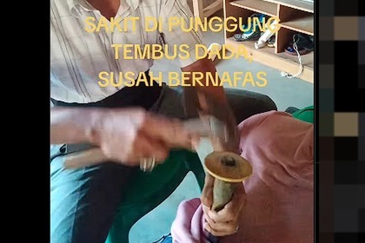 Viral, Video Ketok Palu untuk Atasi Sakit Punggung, Ini Tanggapan Dokter Ortopedi