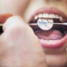 4 Cara Mengatasi Gigi Berlubang secara Medis