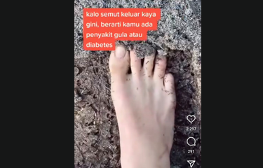 Video Viral Kaki Dikerumuni Semut Diklaim Menjadi Tanda Diabetes ...