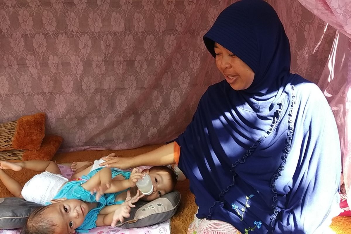 Bayi kembar siam Anaya dan Inaya saat tidur di Gazebo bersama ibunya