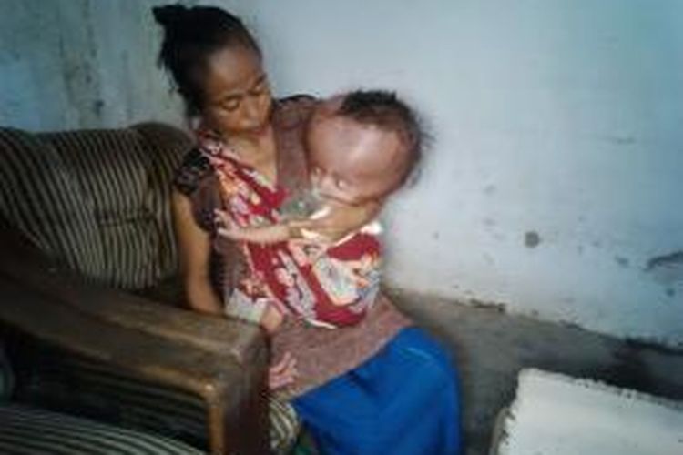 Bayi penderita hidrosefalus Muhammad Fikri (1), Warga Dusun Krajan, Desa Umbulsari, Kecamatan Umbulsari, Jember Jawa Timur, bersama ibunya, Musanah (45).