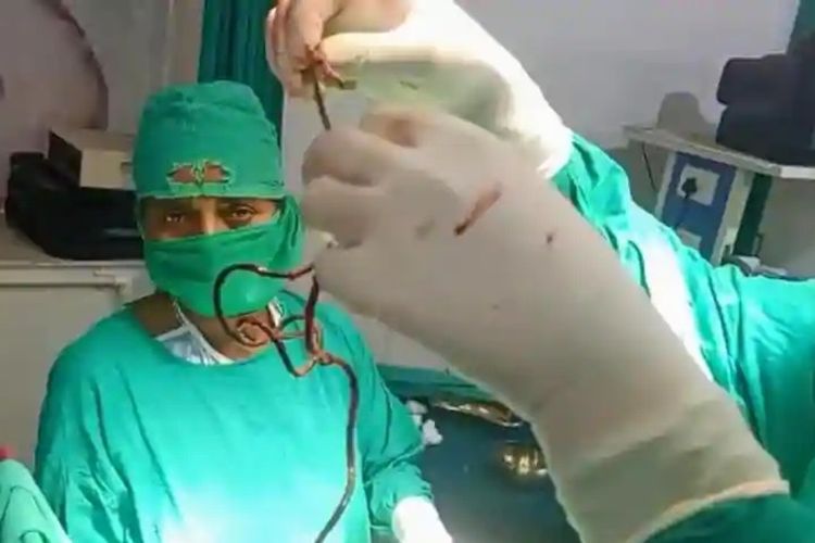 Operasi yang dilakukan Dr Sunil Kumar di India mengangkat dua kabel charger dari penis seorang pria. Pria itu disebut melakukannya karena depresi istrinya kawin lari.