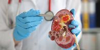Apakah Konsumsi Obat Hipertensi Jangka Panjang Bisa Merusak Ginjal? Ini Kata Dokter