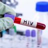 Kapan Sebaiknya Melakukan Tes HIV?