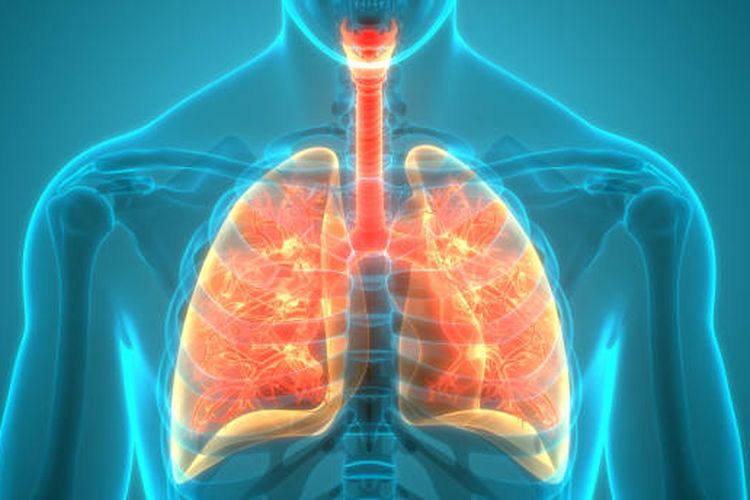 Ilustrasi infeksi paru-paru.