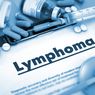 7 Penyebab Kanker Limfoma, Bisa dari Infeksi sampai Implan Payudara