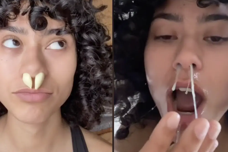 Salah satu tren terbaru yang beredar di TikTok menyebut, memasukan bawang putih ke lubang hidung bisa menjadi cara untuk mengatasi masalah pilek. 