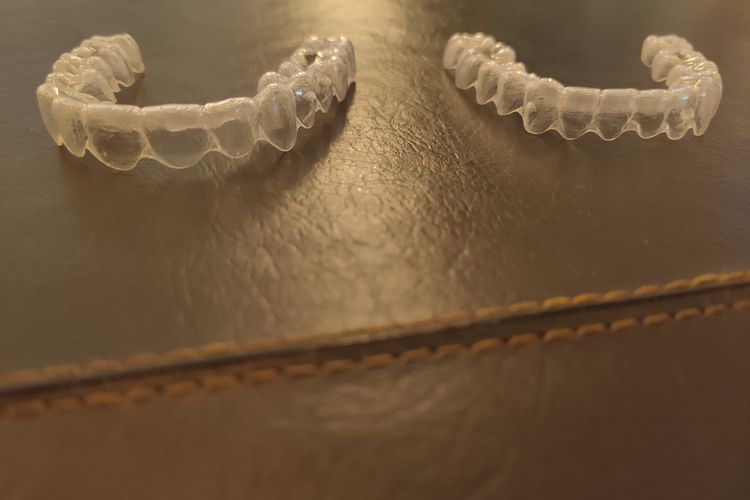 Kawat gigi transparan atau invisible braces atau aligner.