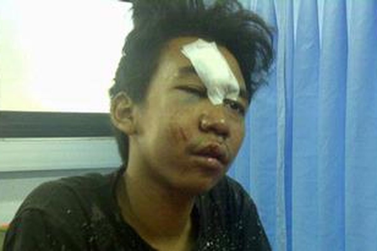 Korban Geng Motor, Nendi Haryanto (22), warga Jalan Lontar, Gg Mutiara, Minangkabau, Jakarta Selatan, Jumat (13/4/2012), di Rumah Sakit Islam Cempaka Putih, Jakarta Pusat.
