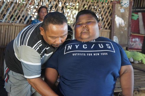 Satia, Bocah Obesitas Asal Karawang Akan Jalani Pemeriksaan di Rumah Sakit