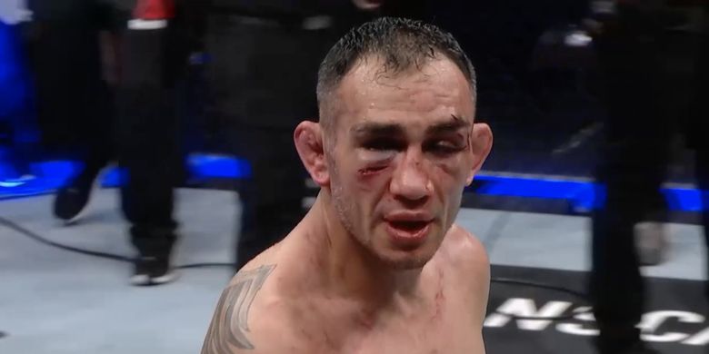 Luka-luka di muka Tony Ferguson setelah pertarungan menghadapi Justin Gaethje di UFC 249, Minggu (10/5/2020) pagi WIB.