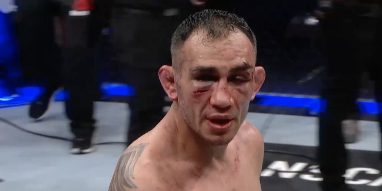 Wajah Tony Ferguson mengalami cedera usai laga melawan Justin Gaethje di UFC 249, Minggu (10/5/2020) dini hari WIB.