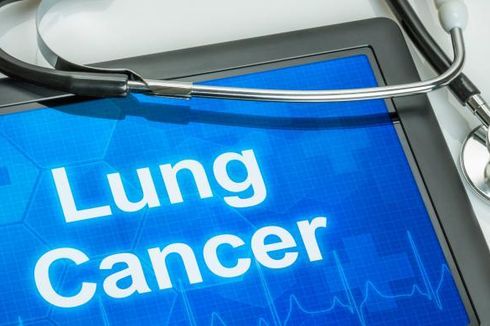 Belum Ada Skriningnya, Bagaimana Kita Bisa Cek Kanker Paru?