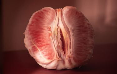 6 Penyebab Vagina Hitam, Termasuk Akibat Gesekan Halaman all ...