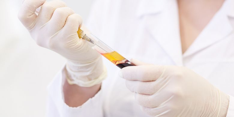 Syarat Donor Plasma Konvalesen Untuk Pasien Covid 19 Halaman All Kompas Com