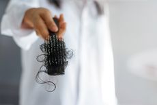 Hair Fall atau Hair Loss, Apa yang Terjadi dengan Rambutmu dan Bagaimana Mengatasinya?