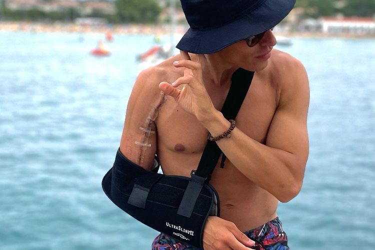 Kondisi lengan Marc Marquez setelah operasi keempat