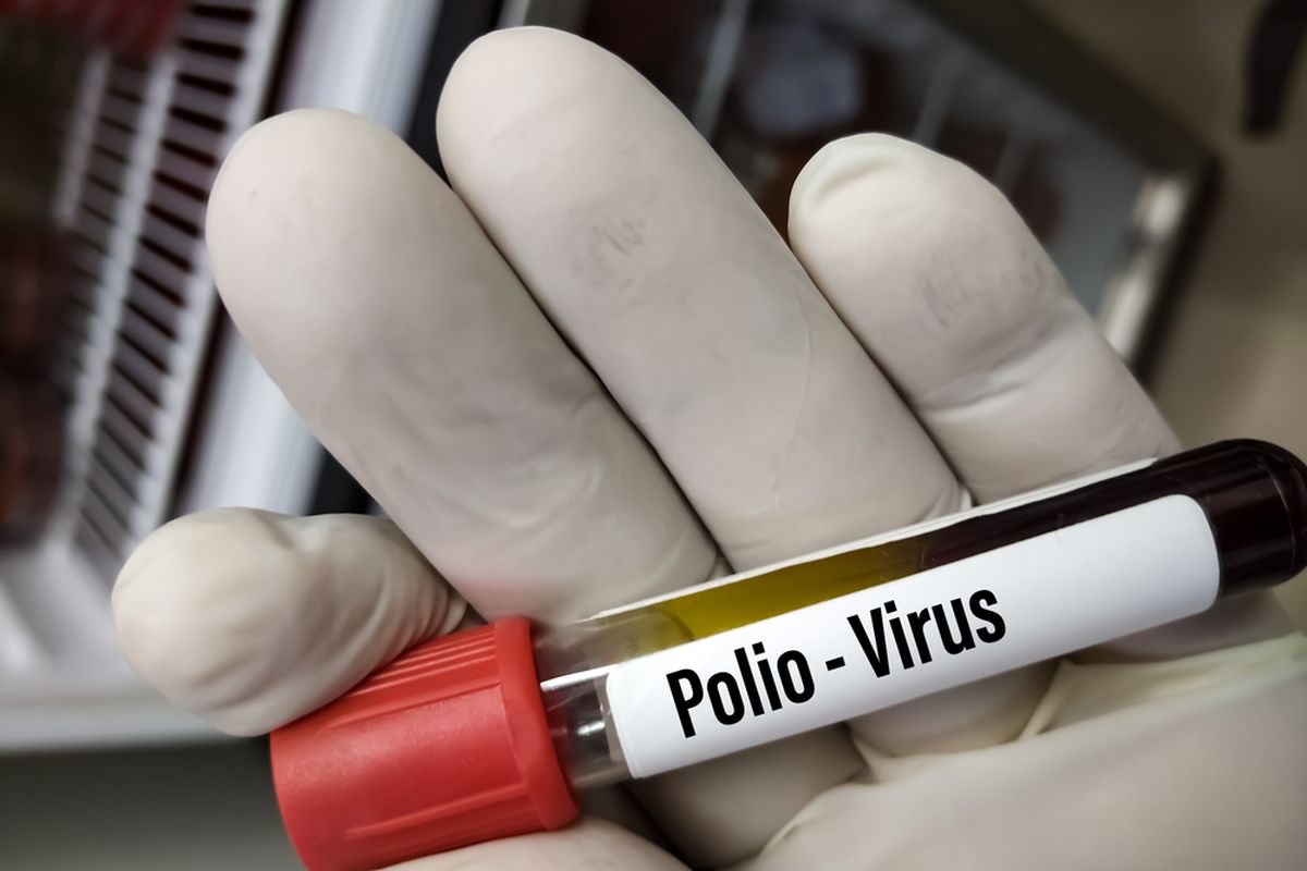 Kementerian Kesehatan (Kemenkes) menjelaskan, perilaku buang air besar yang benar dapat mencegah penyebaran infeksi virus polio. 