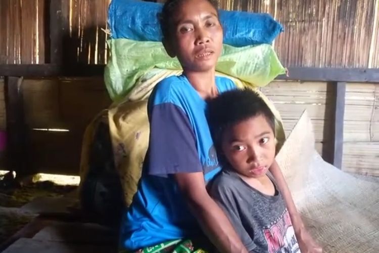 Foto : Karlianus Damar (11), putra bungsu dari pasangan Longginus Non (43) dan Teresia Amis (37) asal Malip, Desa Lenda, kecamatan Cibal Barat, kabupaten Manggarai, NTT, hingga kini tak  bisa berjalan.