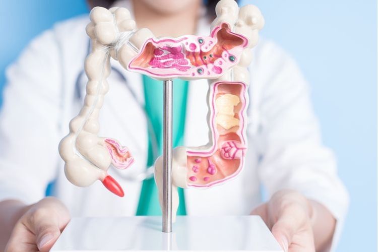 Terapi HIPEC untuk Kanker, Siapa Saja yang Bisa Menjalaninya?