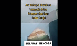 Rebusan Air Kelapa Disebut Dapat Sembuhkan Batu Ginjal, Dokter: Bisanya untuk Mencegah