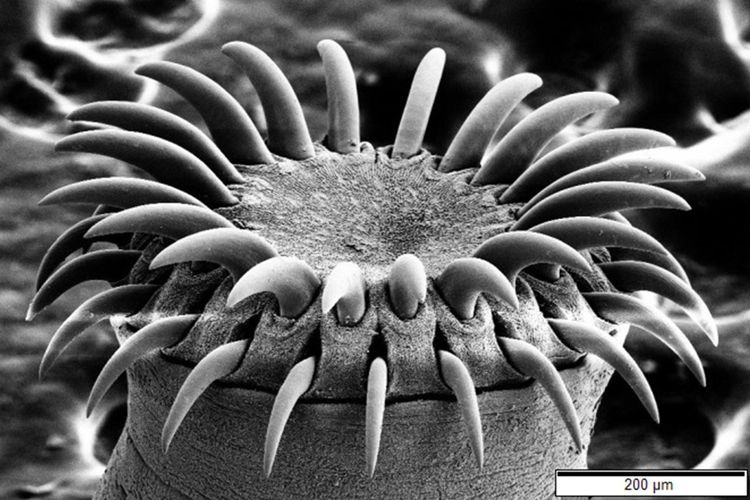 Kepala cacing pita yang dilihat melalui mikroskop elektron
