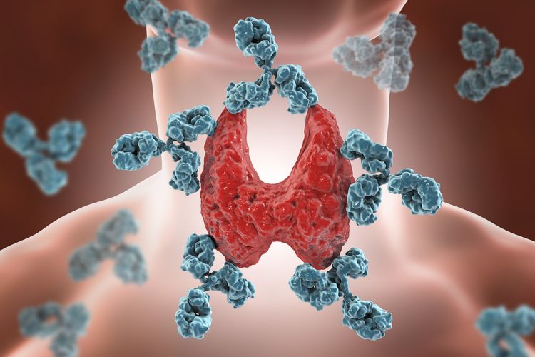 Ilustrasi penyakit autoimun tiroid.