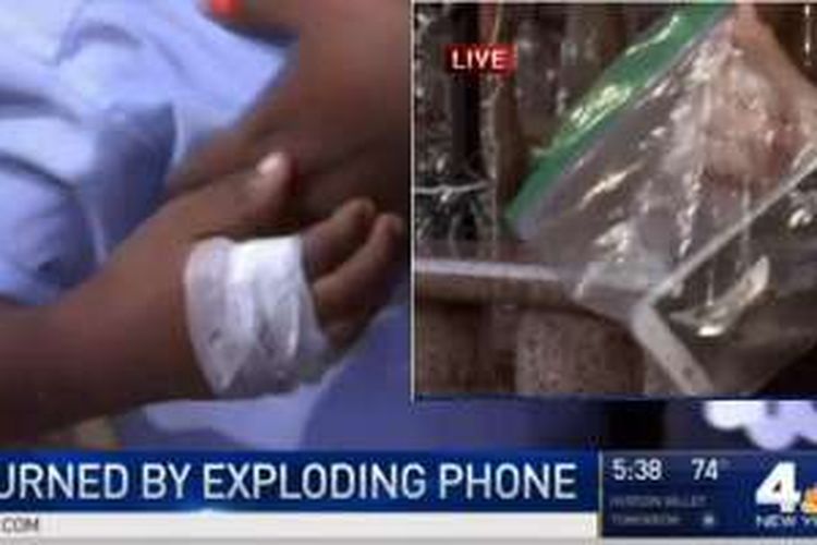 Smartphone Galaxy Core yang meledak dan melukai tangan bocah 6 tahun di Broklyn, New York, AS.
