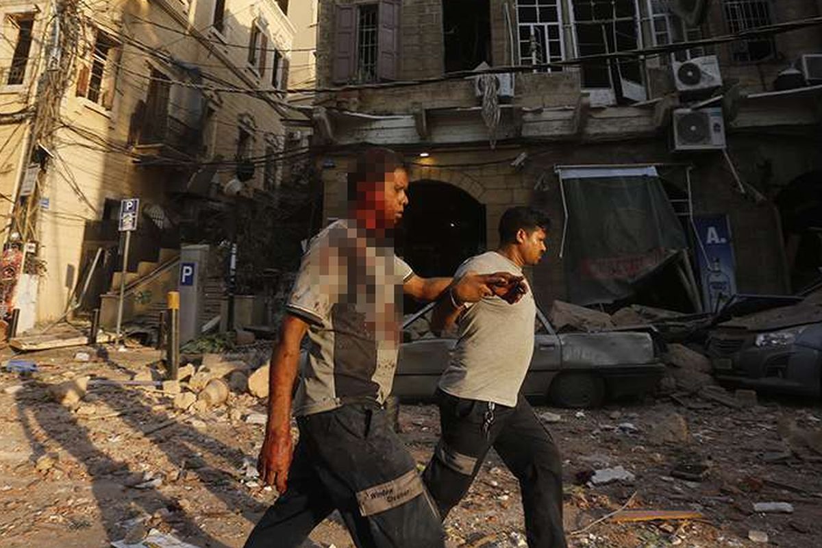 Seorang pria yang terluka dibantu saat berjalan melewati puing-puing di distrik Gemmayzeh, Beirut, Lebanon, usai terjadinya ledakan susulan, Selasa (4/8/2020). Sebanyak 73 orang tewas dan ribuan lainnya dilaporkan terluka dari insiden dua ledakan besar yang mengguncang Beirut tersebut.