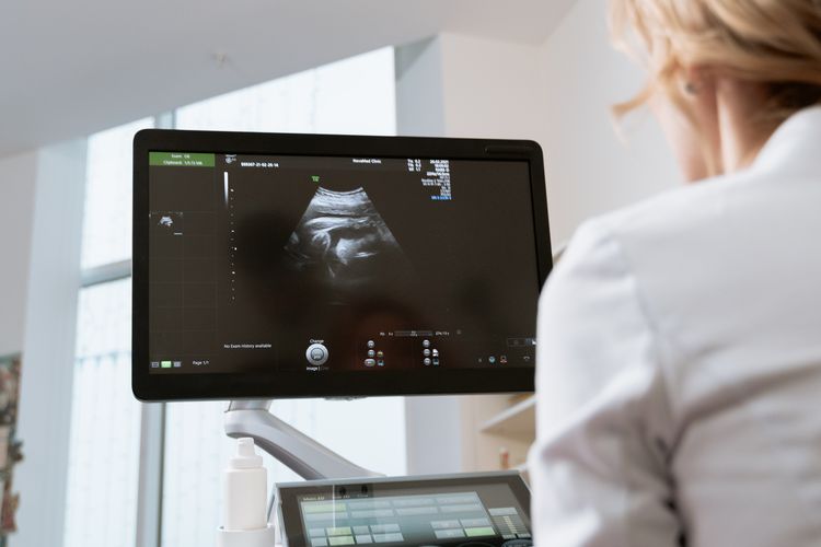 Ilustrasi USG, alat ultrasonografi, alat untuk memeriksa kehamilan, organ tubuh.
