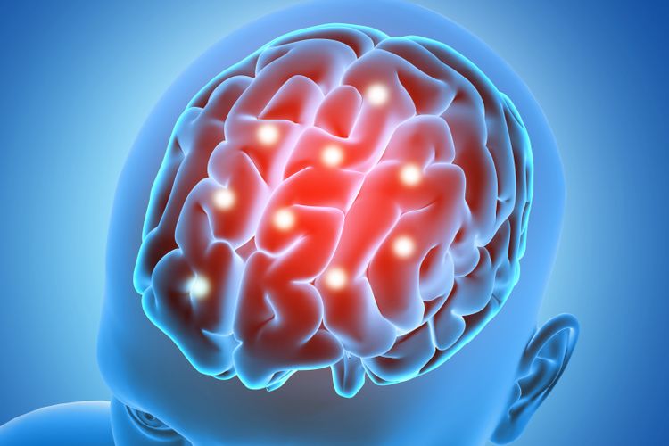 Ilustrasi otak. Penyakit yang identik dengan lansia ini berkembang cepat pada Andre Yarham, merenggut kemampuan bicara, perilaku, dan kemandirian saat hidupnya baru dimulai.