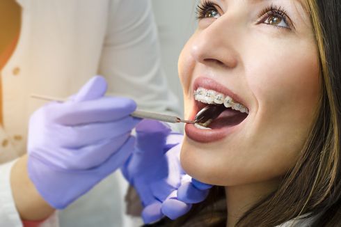 Penemuan Kawat Gigi, Metode Merapikan Gigi sejak Ribuan Tahun Lalu