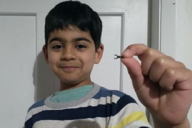 Samir Anwar menunjukkan potongan Lego yang keluar dari hidungnya. Benda tersebut terus berada di hidung Samir selama dua tahun terakhir.