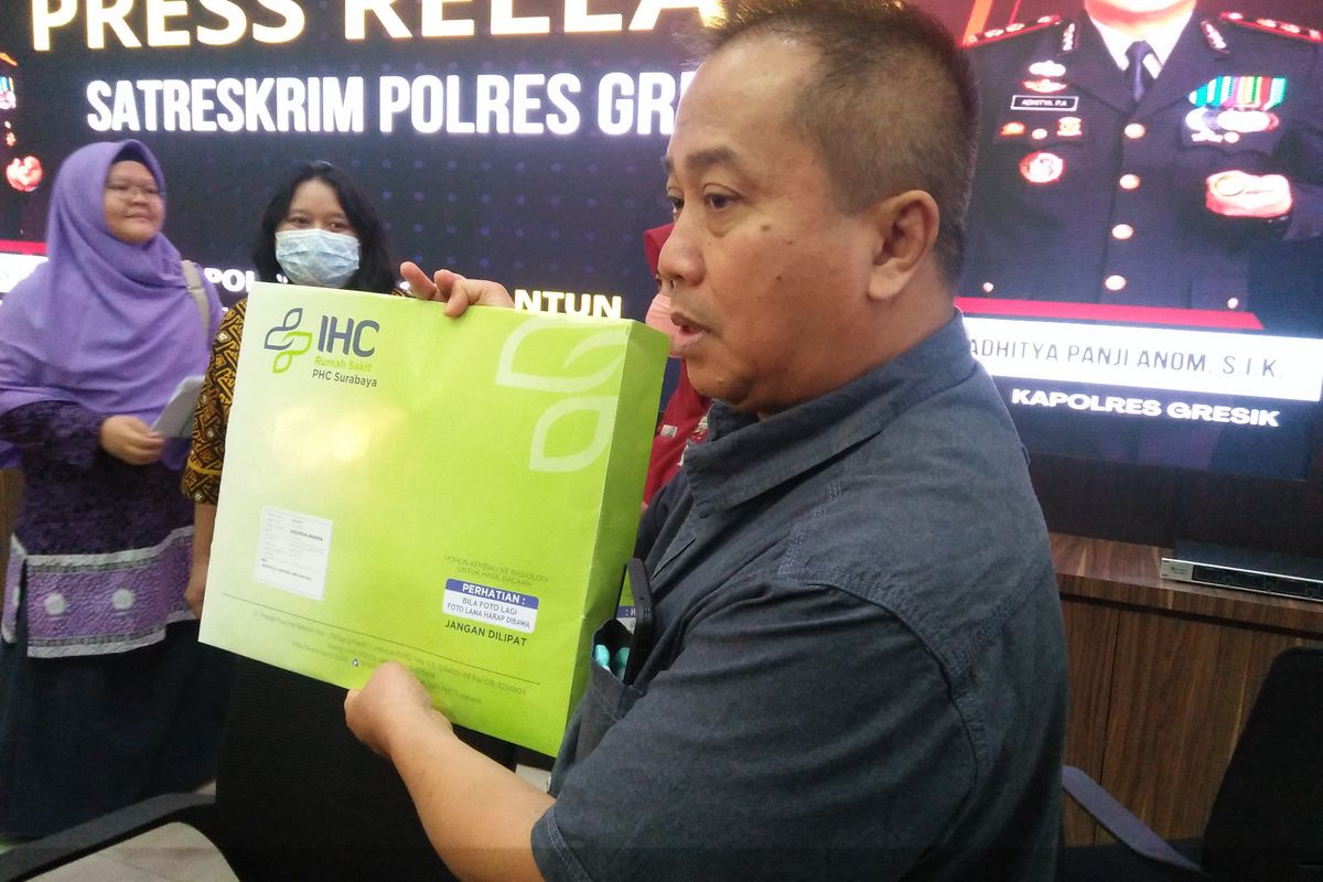 Dokter spesialis mata RSUD Ibnu Sina Bambang Tuhariyanto menunjukkan hasil pemeriksaan MRI siswi berinisial SAH, yang ditengarai mengalami buta akibat dicolok tusuk bakso oleh siswa lain, Kamis (21/9/2023).