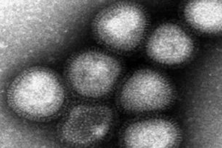 Virus H7N9
