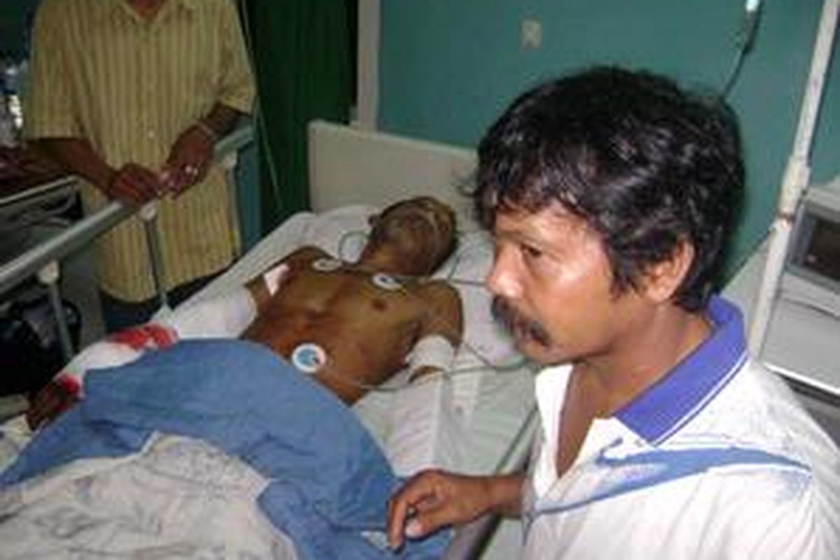 Muhammad Husaini terbaring di RS setelah duel melawan buaya di Penajam Paser Utara (PPU) Kalimantan Timur.