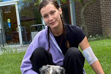 Bella Hadid Ungkap Kondisi Setelah 15 Tahun Berjuang Sembuh dari Penyakit Lyme