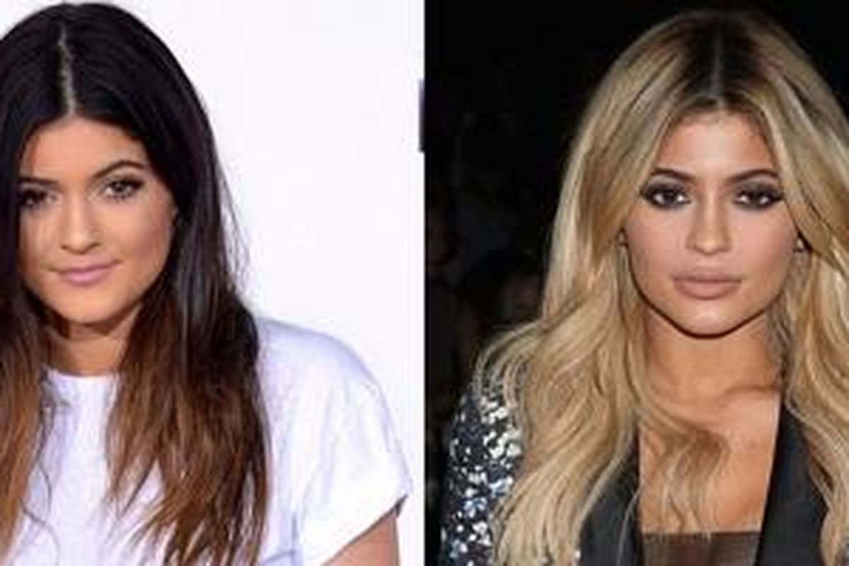 Transformasi Kylie Jenner: (kiri) saat ditemui tahun 2013 dan (kanan) berpose pada sebuah acara tahun 2015 baru-baru ini.