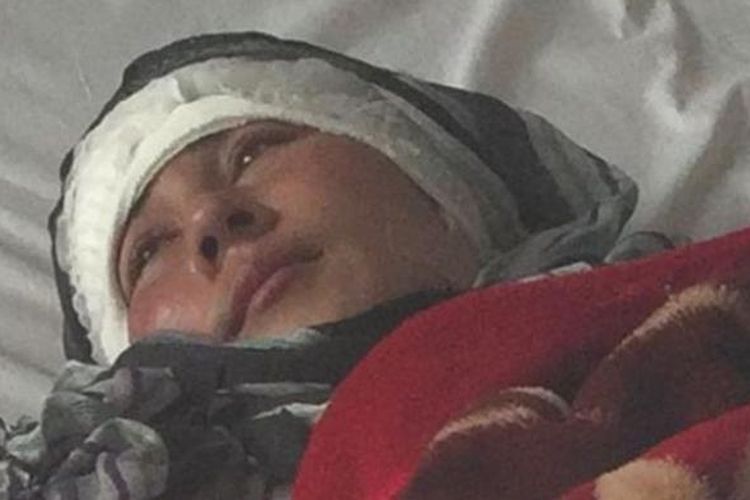 Zarina (23) tergolek lemah di rumah sakit setelah keduanya telinganya dipotong sang suami.