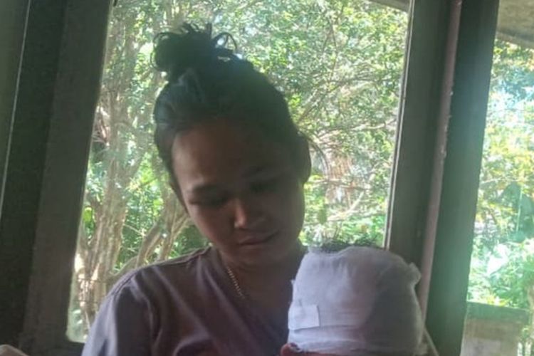 Teror Monyet Liar Serang Cianjur, Bocah Alami Luka Parah, Warga Resah