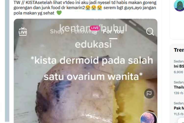 Tangkapan layar unggahan menyebut bahwa adanya kista dermoid pada salah satu ovarium