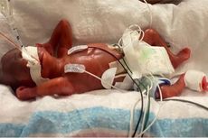 Kisah Curtis Means, Bayi Paling Prematur di Dunia yang Berhasil Bertahan Hidup