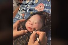 Video Viral Pipi Bayi Ditusuk untuk Bentuk Lesung Pipi, Ini Kata Dokter