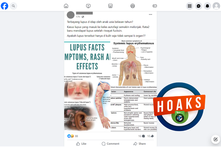 Tangkapan layar konten hoaks di sebuah akun Facebook, Selasa (23/1/2024), soal penyakit lupus pada anak usia belasan dikaitkan dengan vaksin.