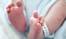 14 Tanda-tanda Lupus Neonatal yang Perlu Diperhatikan