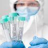 Apakah PCR dan Antigen Efektif Mendeteksi Varian Omicron?