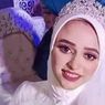 Kena Serangan Jantung, Pengantin Wanita Ini Meninggal 1 Jam setelah Menikah