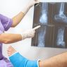 Bagaimana Patah Tulang Bisa Sembuh? Kenali 4 Fase Penyembuhannya