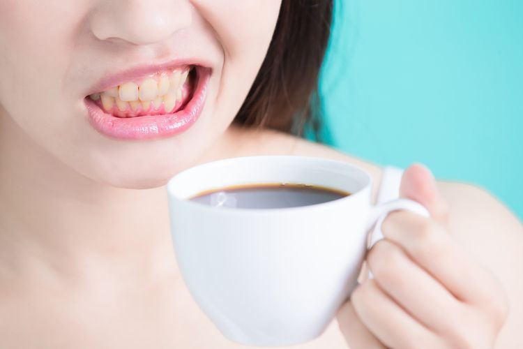 Gigi rusak bisa karena 5 jenis makanan dan minuman. 